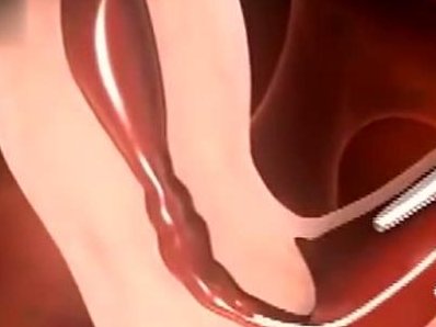 湖南无结婚证试管基因检测，未婚PGS／PGD费用差异+2026医院推荐